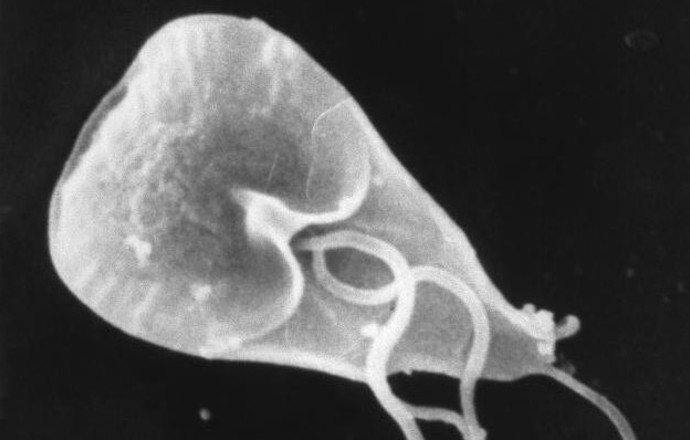 Giardioza – obraz kliniczny, diagnostyka i leczenie