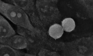 Nanocząstki złota zabijają nowotwory, ale nie tak, jak myślano