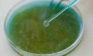 Biomateriały nowej generacji. Naukowcy stworzyli żel, który regeneruje się jak skóra