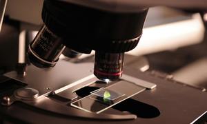 Popularny znacznik biologiczny może wprowadzać w błąd