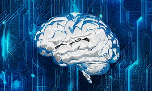 Nowa platforma robotyczna w diagnostyce naczyń mózgowych